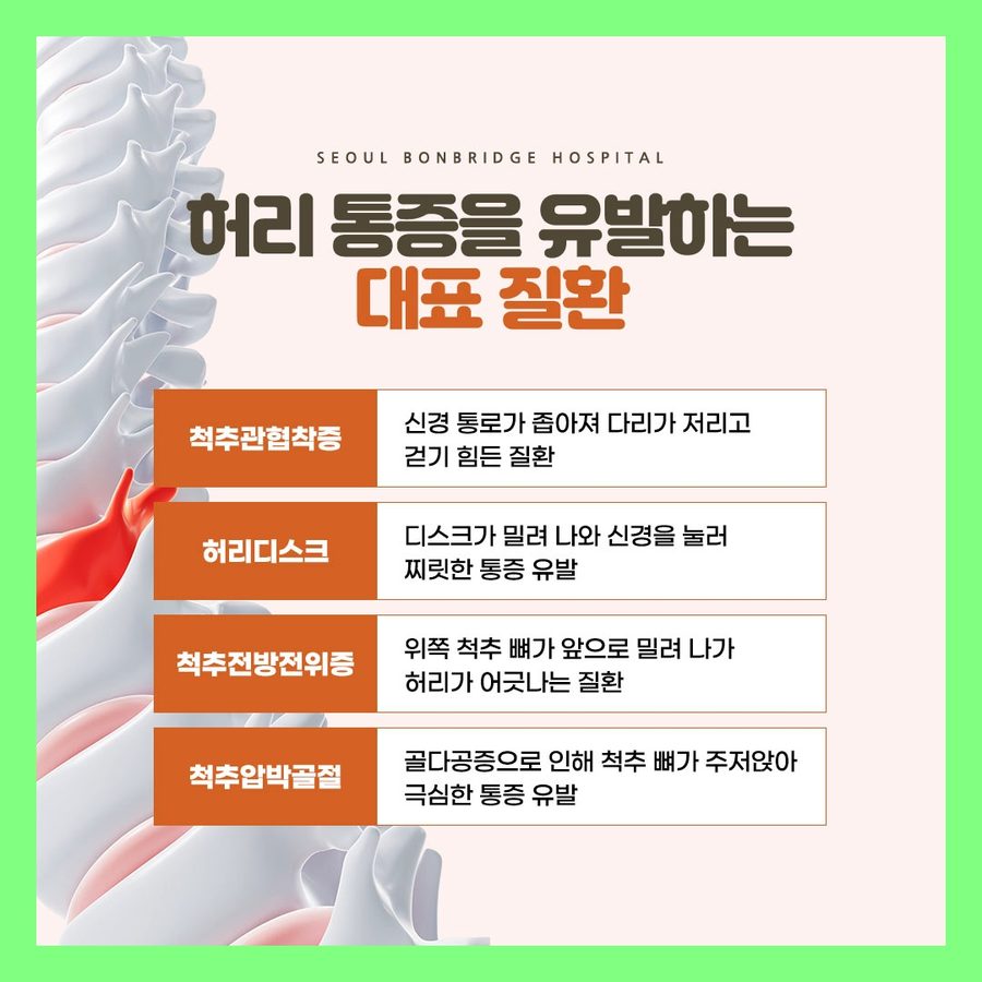 허리 통증을 유발하는 대표 질환 척추관협착증 허리디스크 서울본브릿지병원 안내