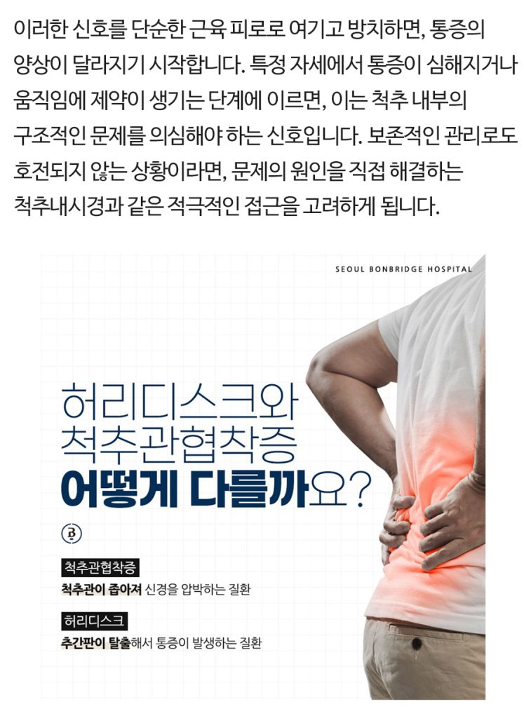 척추내시경 (2)