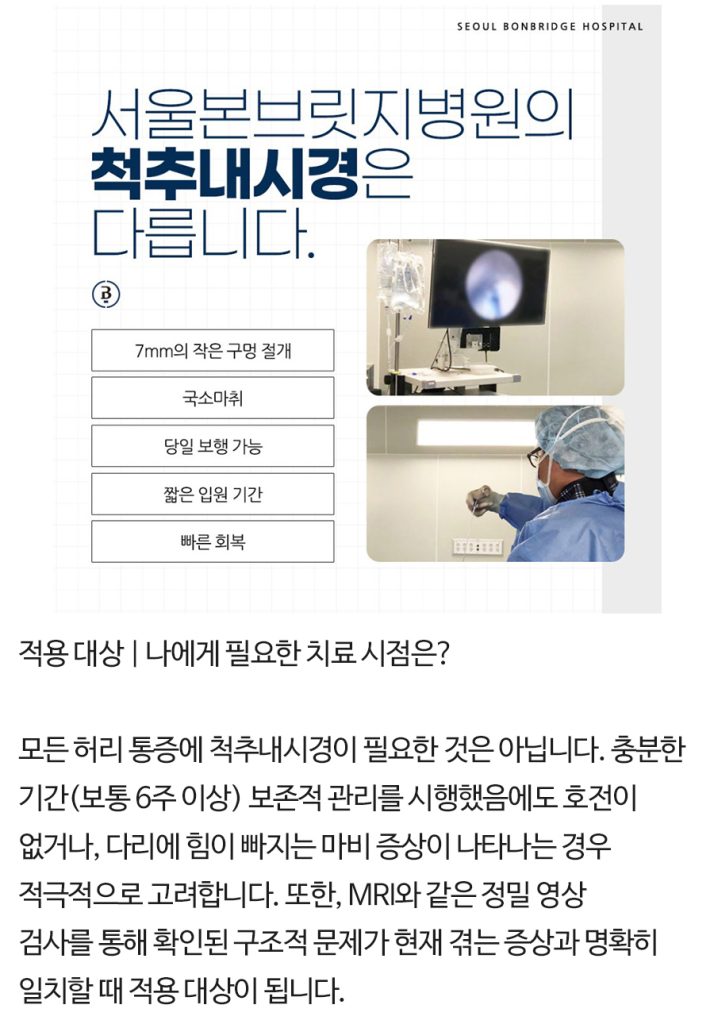 척추내시경 (7)