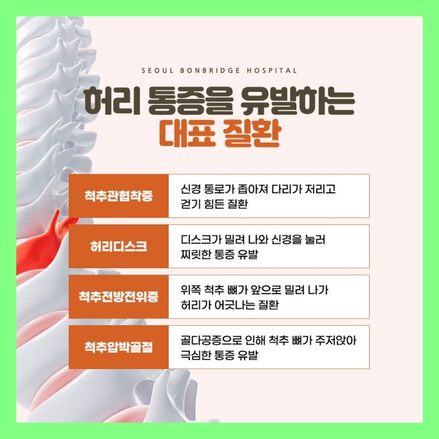 척추관협착증 수술, 언제 결정해야 할까요 서울본브릿지병원